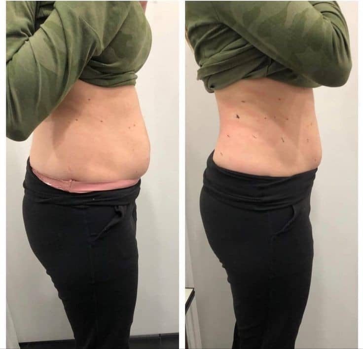 چرا مرکز هدارا بهترین انتخاب برای لاغری و زیبایی است؟