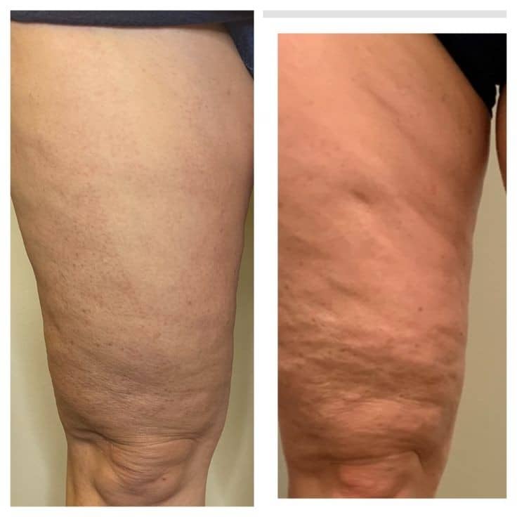 انواع خدمات لاغری و زیبایی ارائه شده در مرکز هدارا