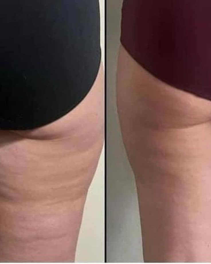 روش ایمن لاغری