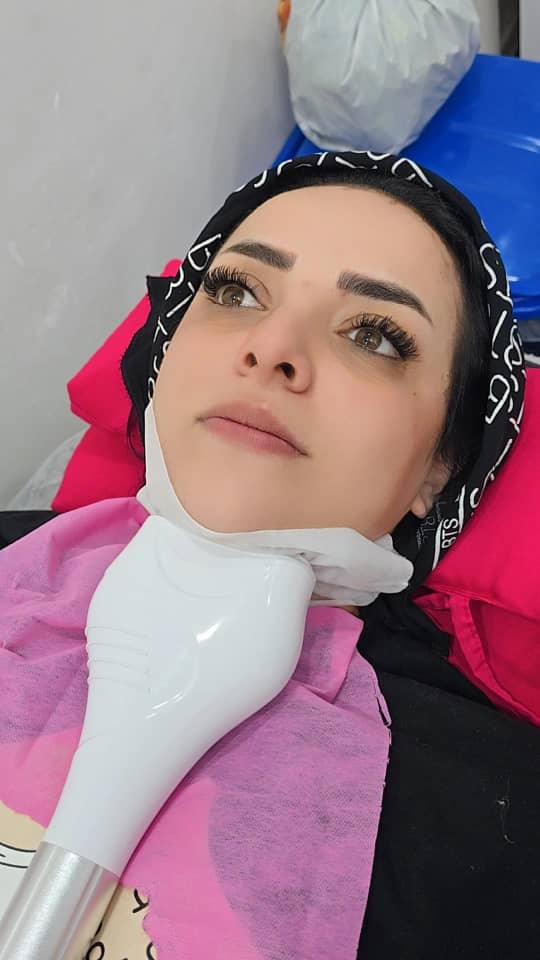 رفع غبغب بدون جراحی